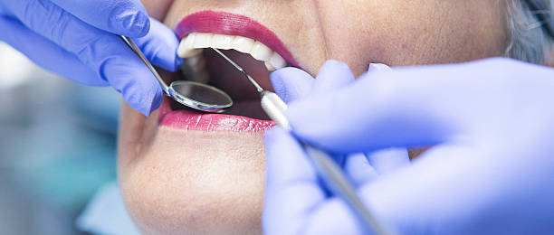Best Broken Tooth Emergency  in Port St Lucie, FL